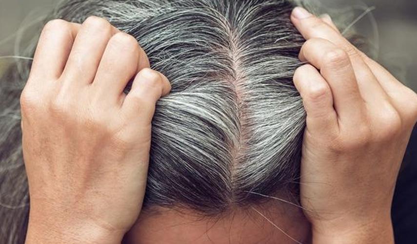 Saçlarımız neden beyazlar? Erken yaşta saçınız beyazlıyorsa sebebi..