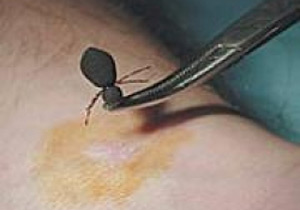 Kene 12 Eylül darbesinin ürünü