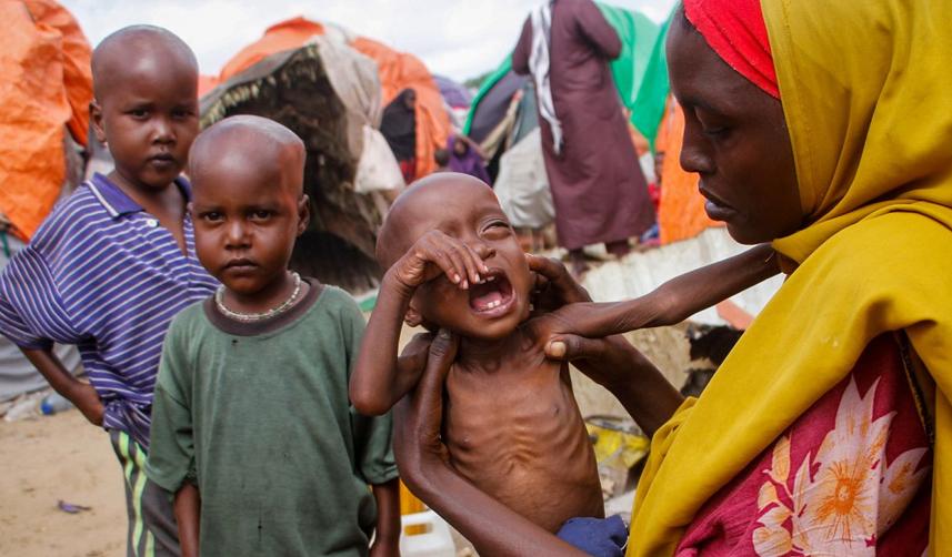 Somali'de yaklaşık 8 milyon kişi yetersiz besleniyor