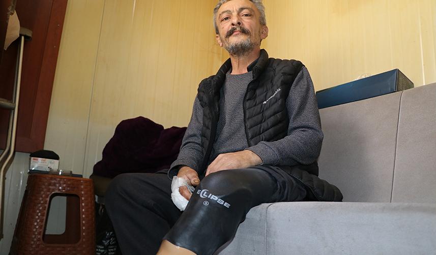 Rize'de protez bacağı ile hayata tutundu