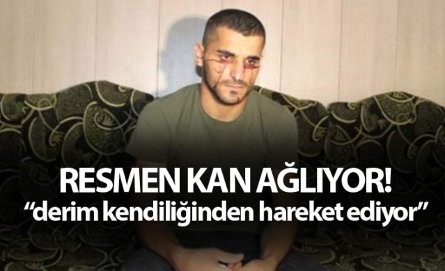 Resmen kan ağlıyor!