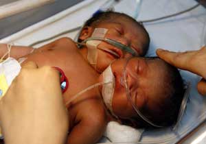 Bu bebeğin iki tane başı var