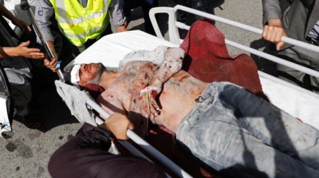 Afganistan kana bulandı