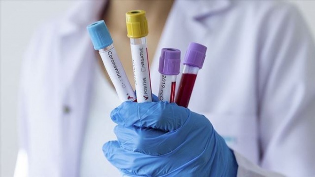 Koronavirüste yaptığınız basit hatalar virüsü kolayca yayıyor!