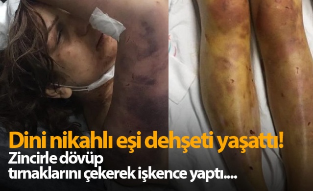 Dini nikahlı eşine dehşeti yaşattı