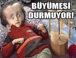 Kafasının büyümesi durmuyor!