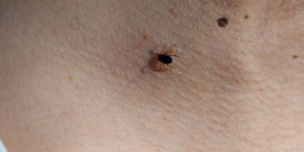 Uzmanlardan flaş kene uyarısı! Mutlaka kontrol edin