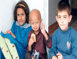 12 yaşında yaşlılıktan öldü