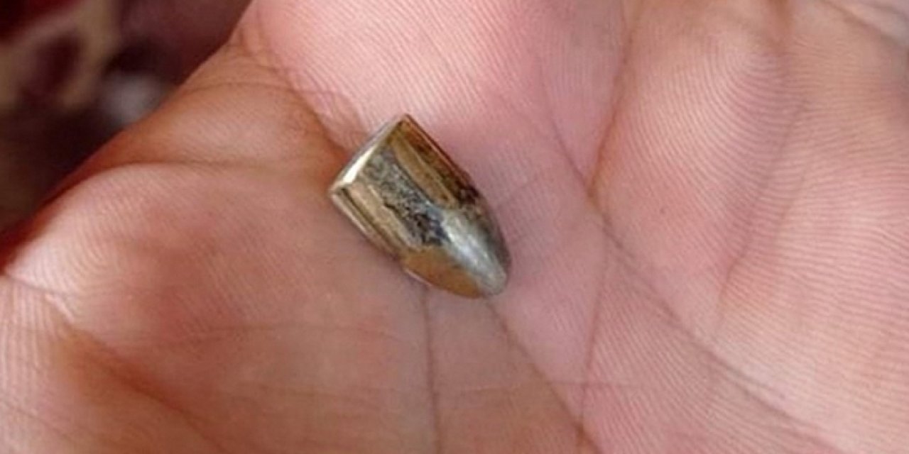 Trabzon'da çocuğa yorgun mermi isabet etmişti! İşte son durumu