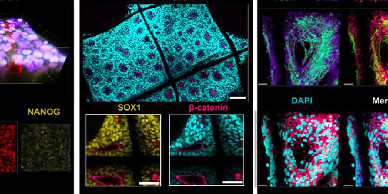 Dünyayı etkileyen hastalığa KTÜ'den ümit ışığı