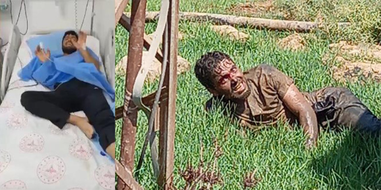 Suriye'den Türkiye'ye kuduz tedavisi için getirilmişti! Sosyal medyada da gündem olan kişi yaşamını yitirdi