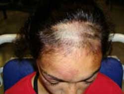 Türk kızına ırkçı saldırı