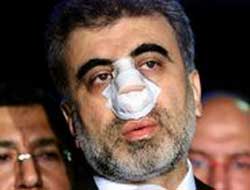 Yumruğun bedeli 5 yıl