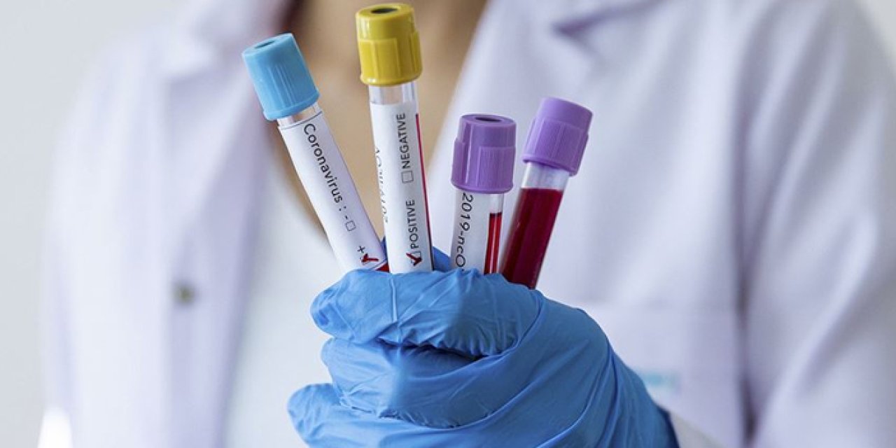 Koronavirüs'te flaş gelişme! Pozitiflik oranı artışı ürküttü!