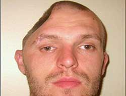 Kafatasının yarısı yok !