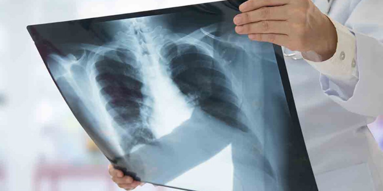 KTÜ'lü profesörden zatürre uyarısı! "Ölümlerim önlenmesi için"