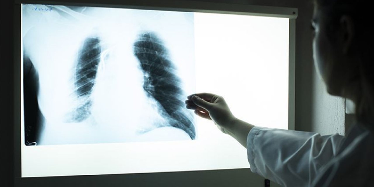 Prof. Dr. Tevfik Özlü'den KOAH uyarısı! "Önlenebilir bir hastalıktır"