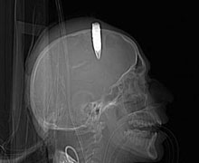 Komutandan öyle korktu ki...