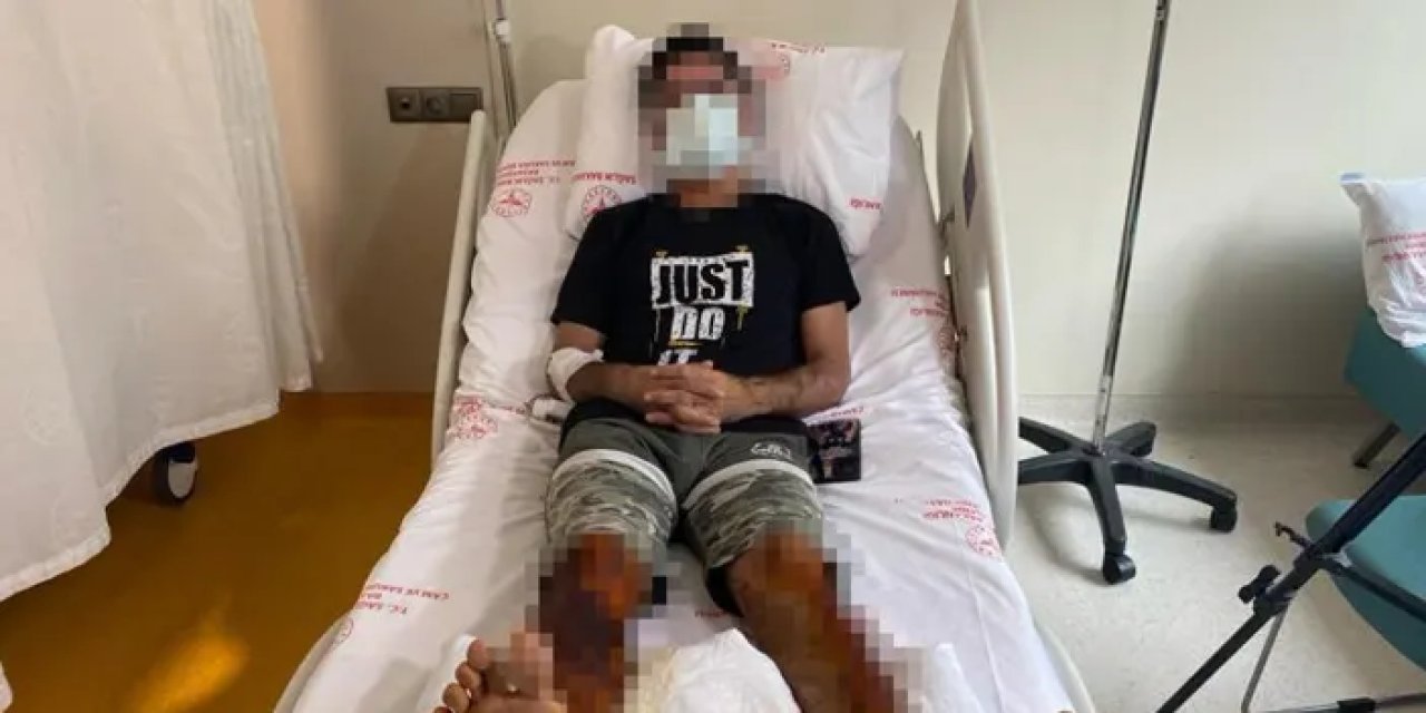 Lavabo açıcı bomba gibi patladı! Vücudunun yüzde 35'i yandı