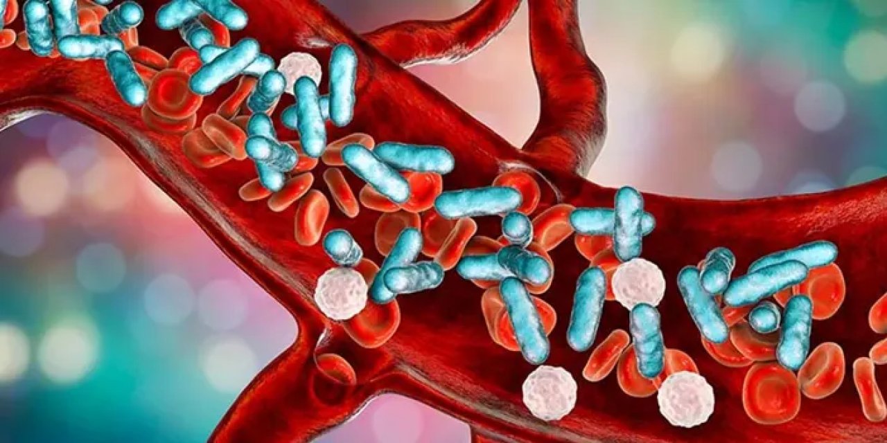 Sepsis nedir? Sepsis belirtileri nelerdir?