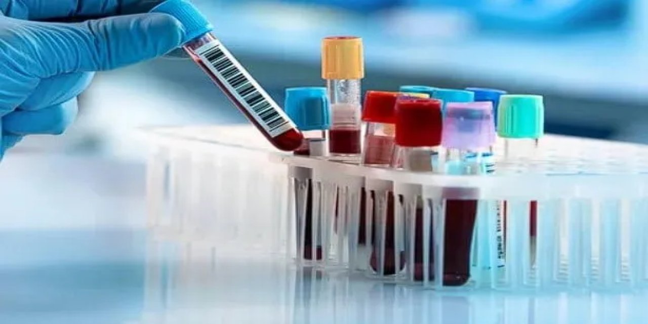 2024 Sağlık Ocağı kan alma saatleri