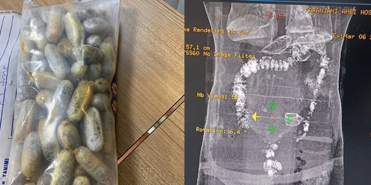 Trabzon’da polisleri bile hayrete düşüren olay! 4 kişinin midesinden çıkarıldı