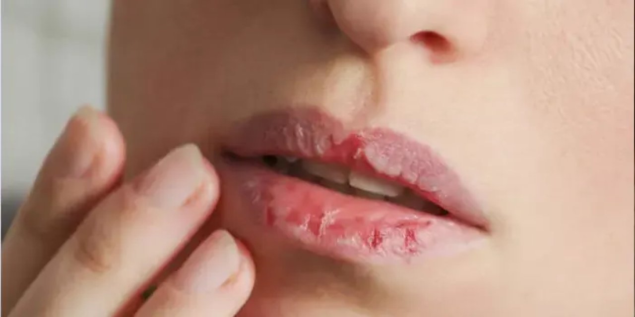 Dudak eti yemek orucu bozar mı?