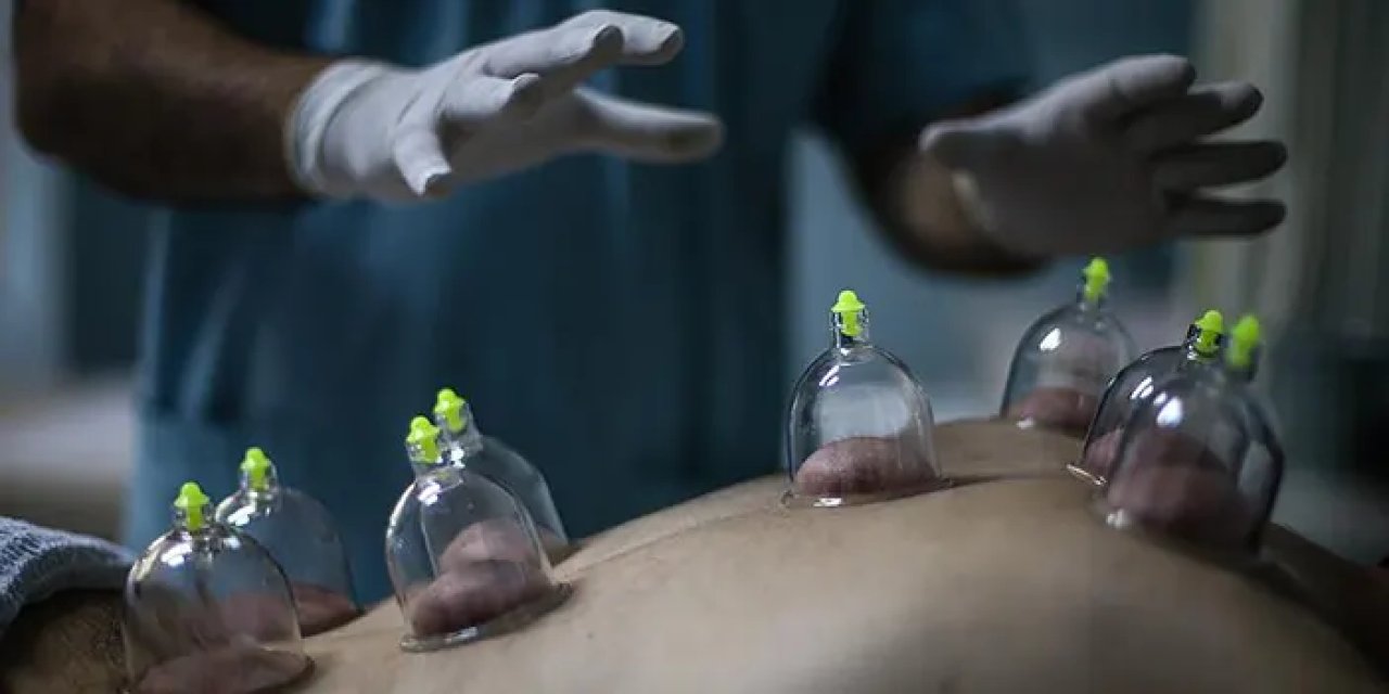 Oruç tutarken hacamat yaptırmak orucu bozar mı? Oruçluyken hacamat yaptırmak orucu bozar mı?