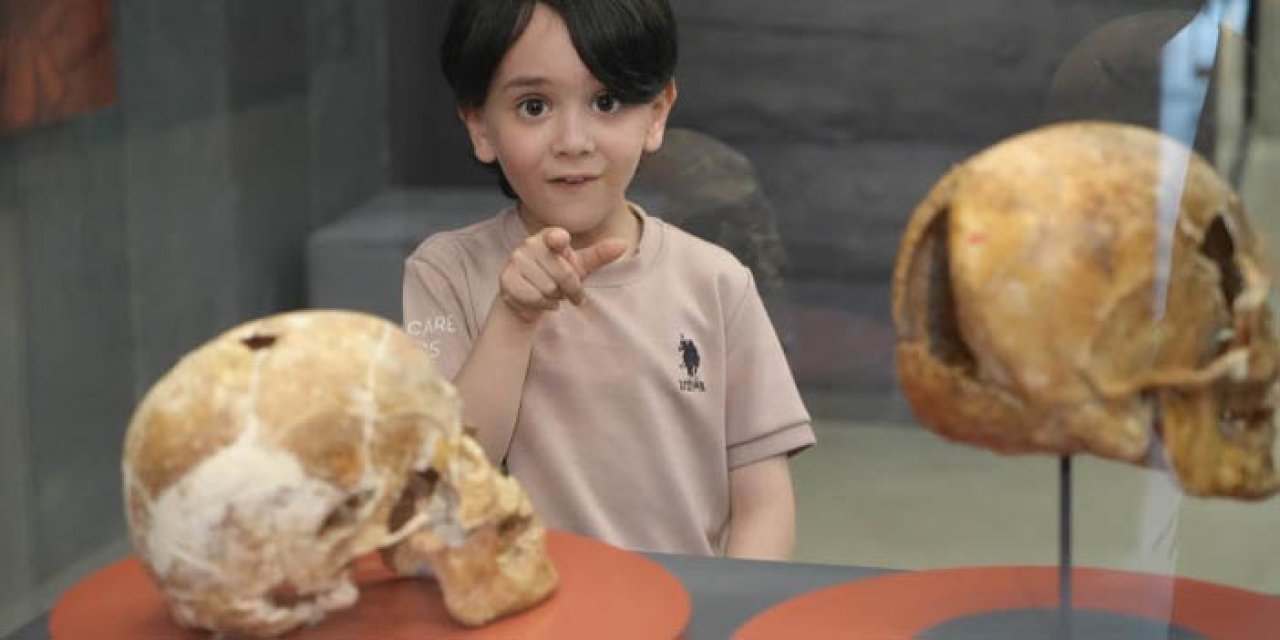 Samsun'da görenler şaşırıyor! 5 yıl önce ameliyat edilen kafatası ilgi topladı