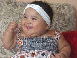 Şaşı çocuklara "üvey" muamelesi