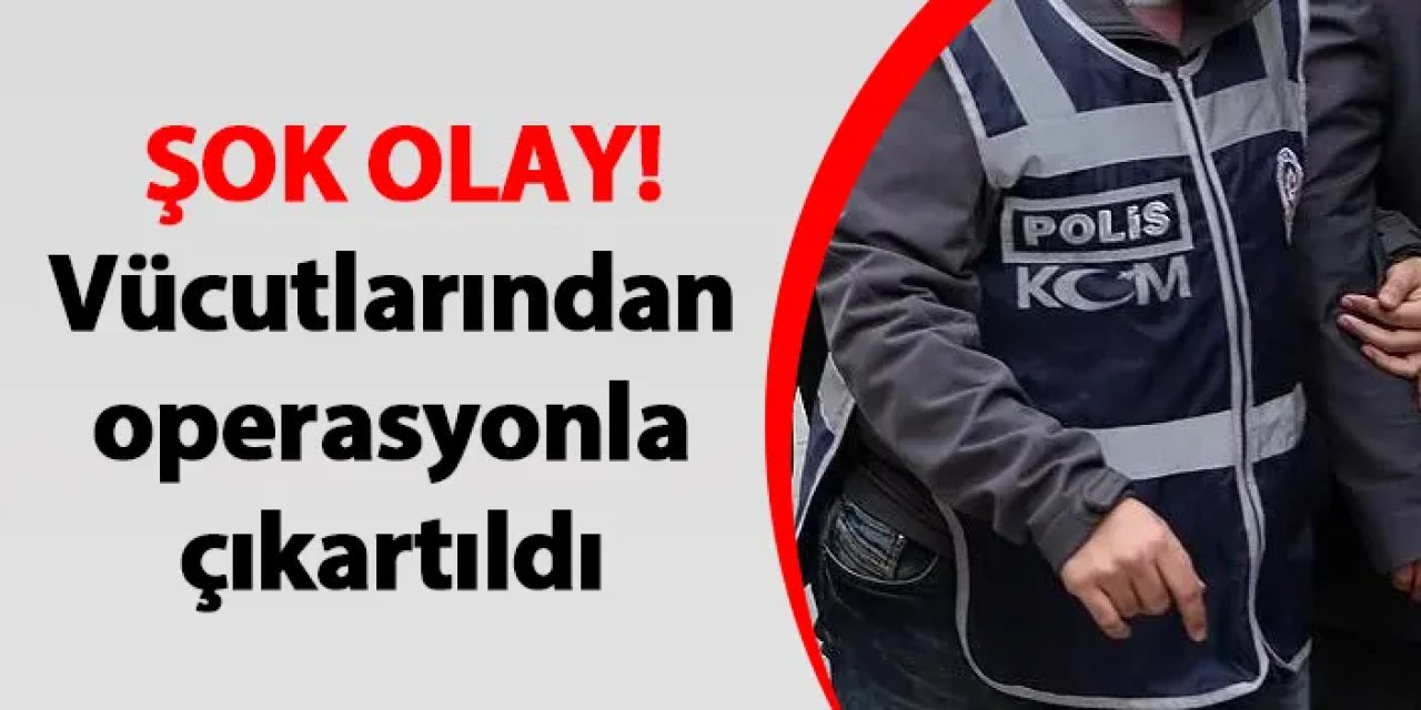 Gümüşhane'de şok olay! Vücutlarından operasyonla çıkartıldı
