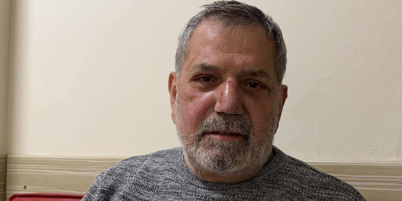 CHP Rize Milletvekili trafik kazasında yaralandı