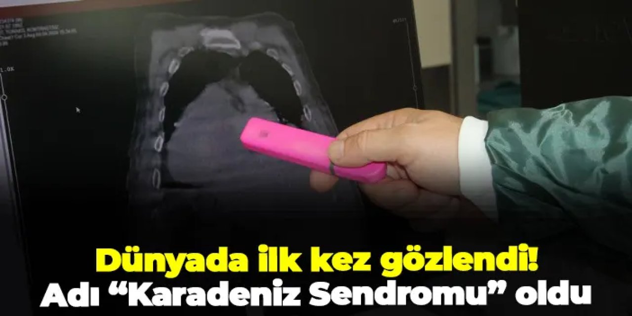 Dünyada ilk kez gözlendi, adı “Karadeniz Sendromu” oldu