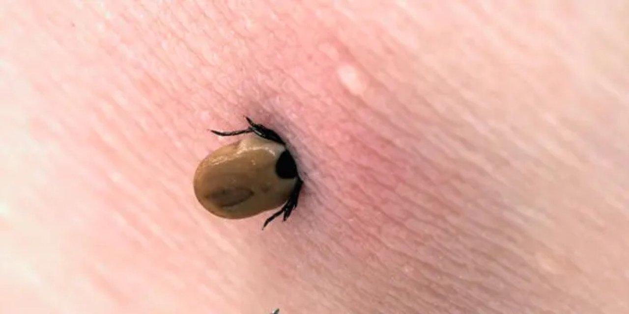 Sivas’ta KKKA şüphesiyle tedavi gören yaşlı hasta hayatını kaybetti