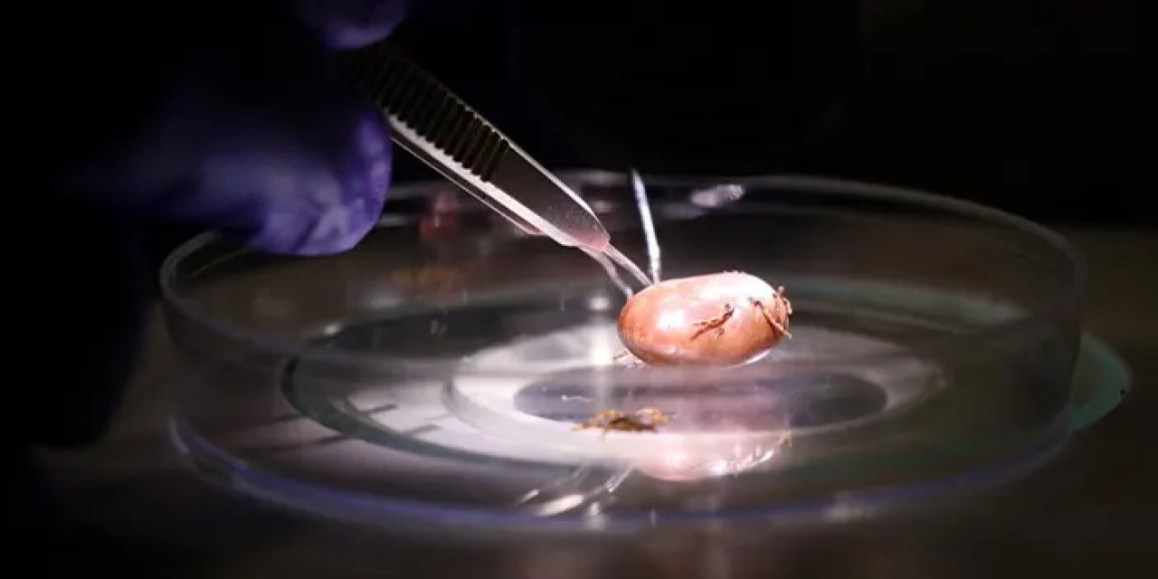 Uzman isim uyardı: Keneye elle müdahale ölümcül olabilir!