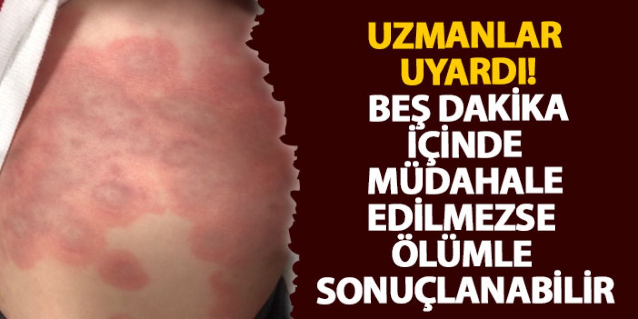 Uzmanlar uyardı! Beş dakika içinde müdahale edilmezse ölümle sonuçlanabilir