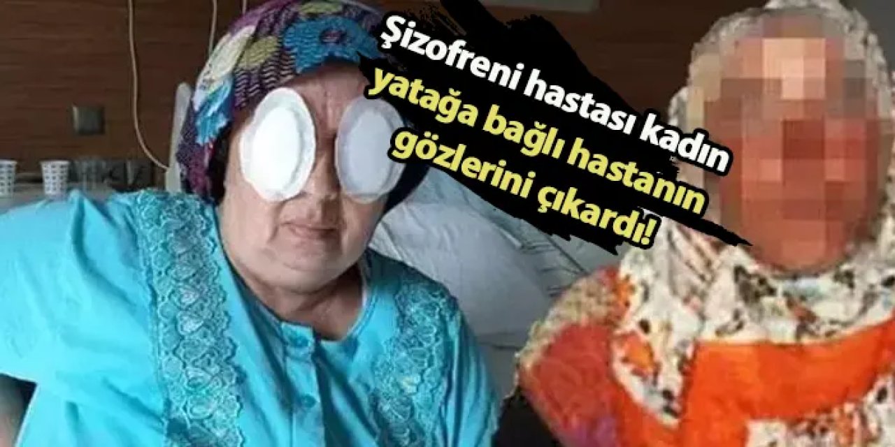 Şizofreni hastası kadın yatağa bağlı hastanın gözlerini çıkardı!