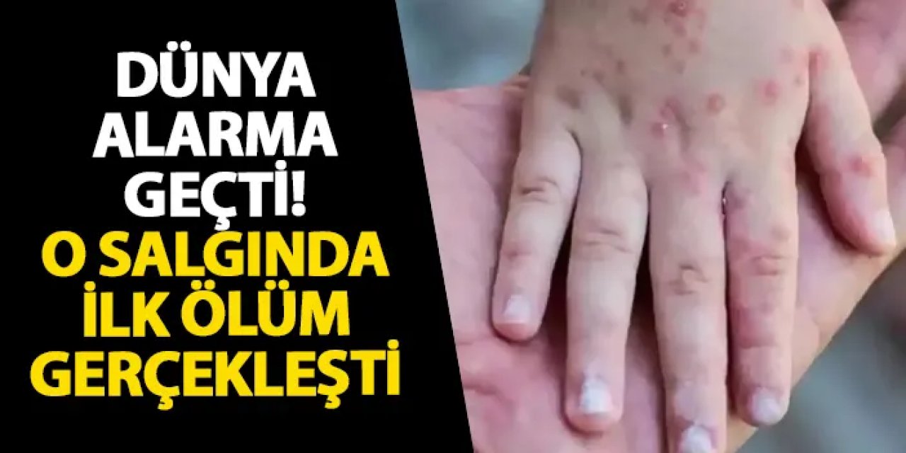 Dünya alarma geçti! O salgında ilk ölüm gerçekleşti