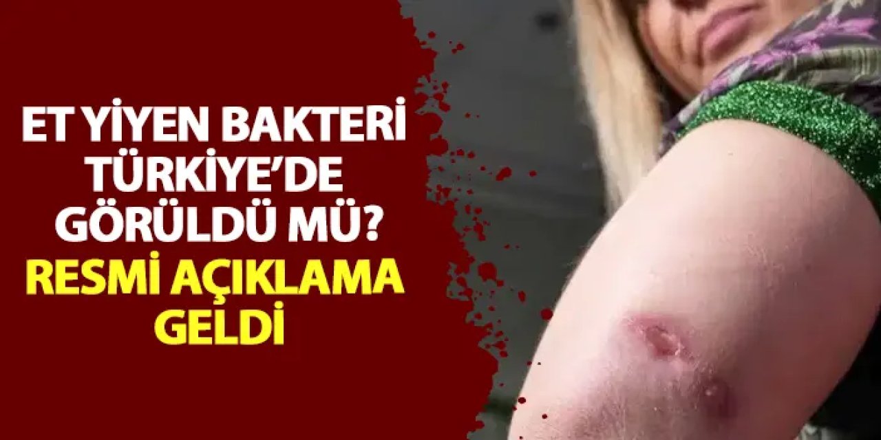 Et yiyen bakteri Türkiye’de görüldü mü? Resmi açıklama geldi