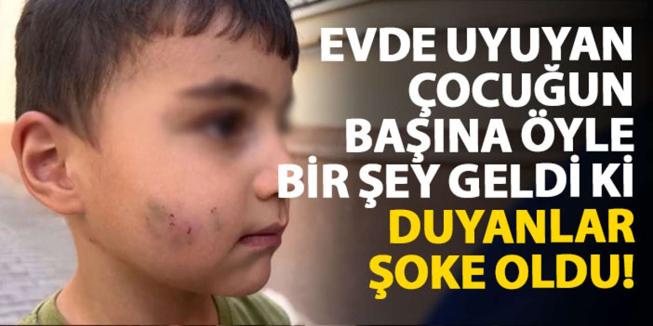 Evde uyuyan çocuğun başına öyle bir şey geldi ki duyanlar şoke oldu!