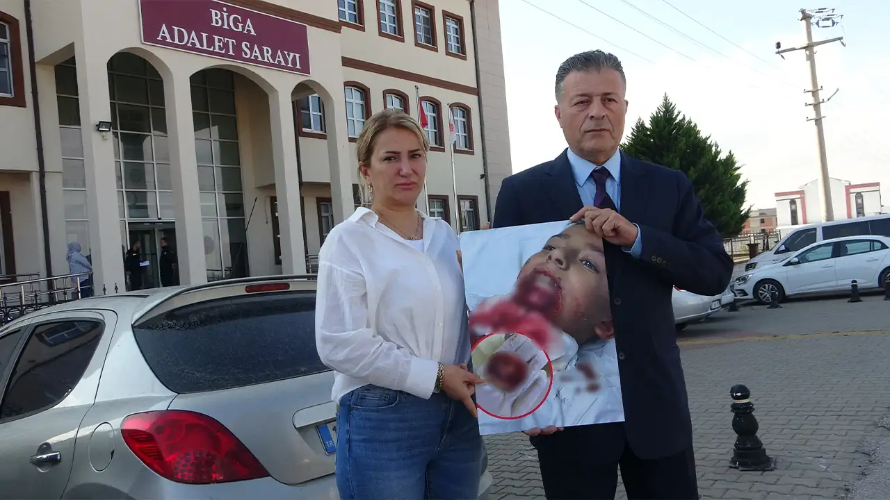 Kocaeli'de ilkokul öğrencisinin çenesi koptu: Aile adalet arıyor