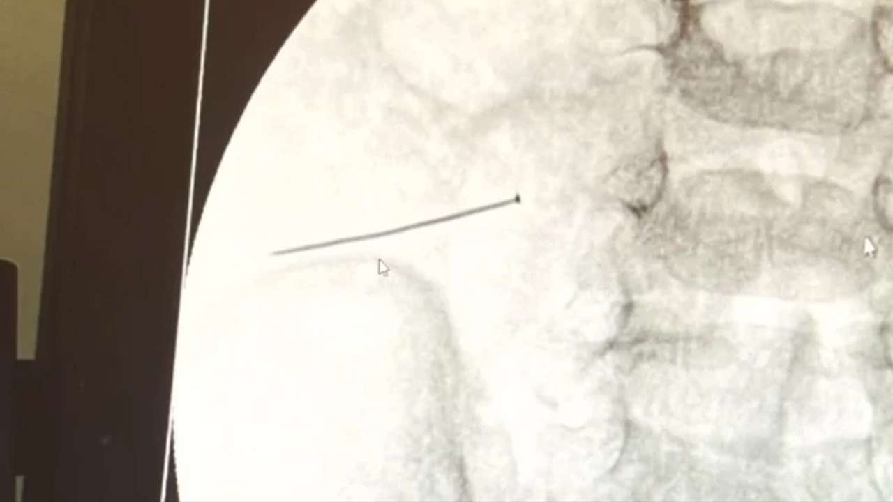 2 yaşındaki çocuk sancıyla hastaneye koştu, gerçek şoke etti