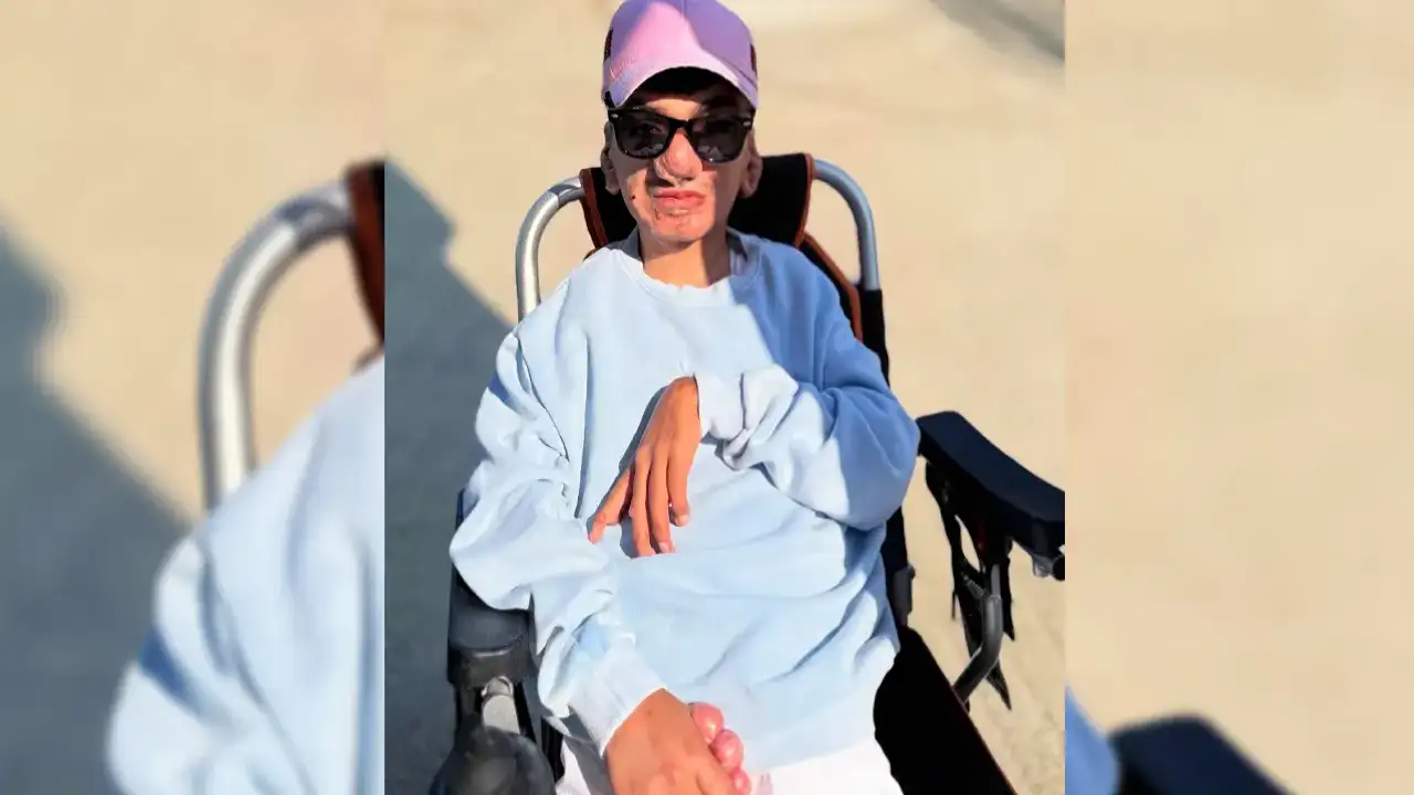 Trabzon'da Haydarcan’ın sessiz mücadelesi: “Vücudumdaki her iz, hayata karşı imzam”