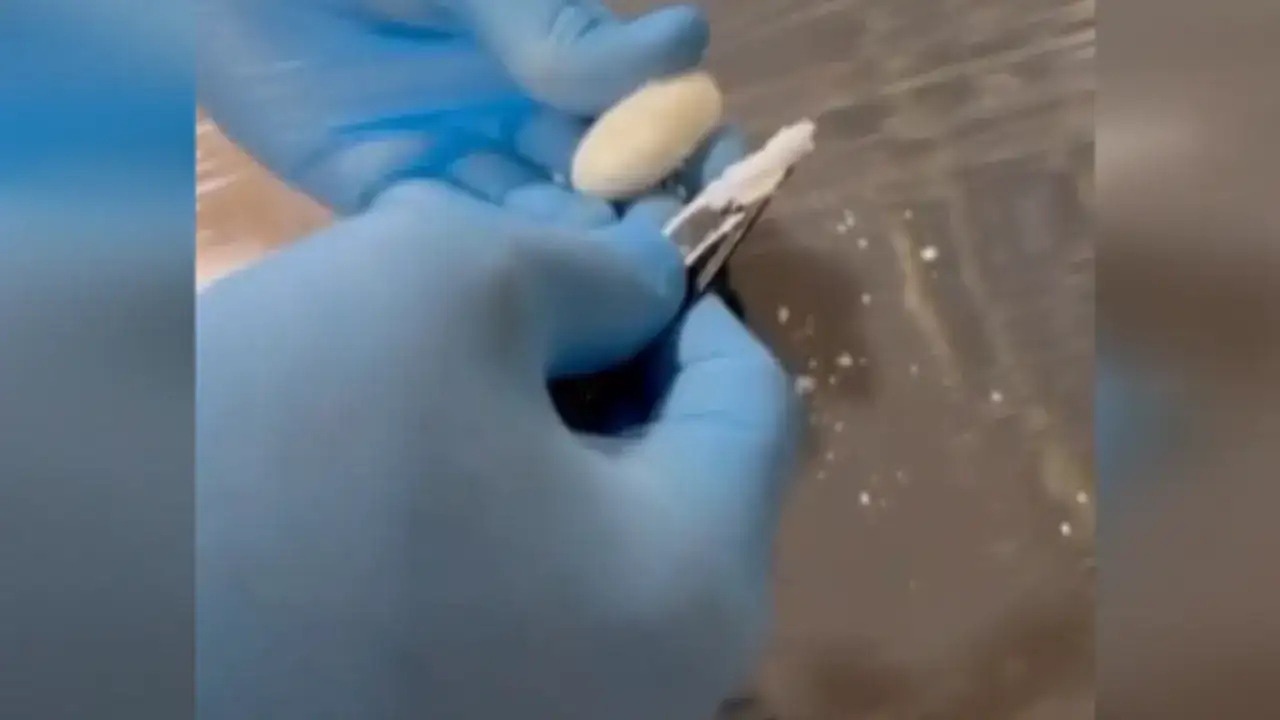 Şüpheli hareketleri ele verdi: Midesinden uyuşturucu çıktı