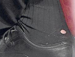 Başbakan'ın çorabı yırtık çıktı!