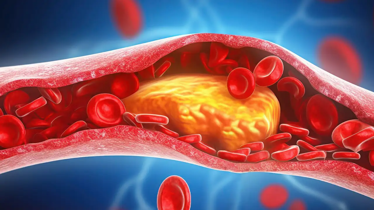 Kolesterol nedir? Kolesterol belirtileri nelerdir? Kolesterol nasıl düşürülür?