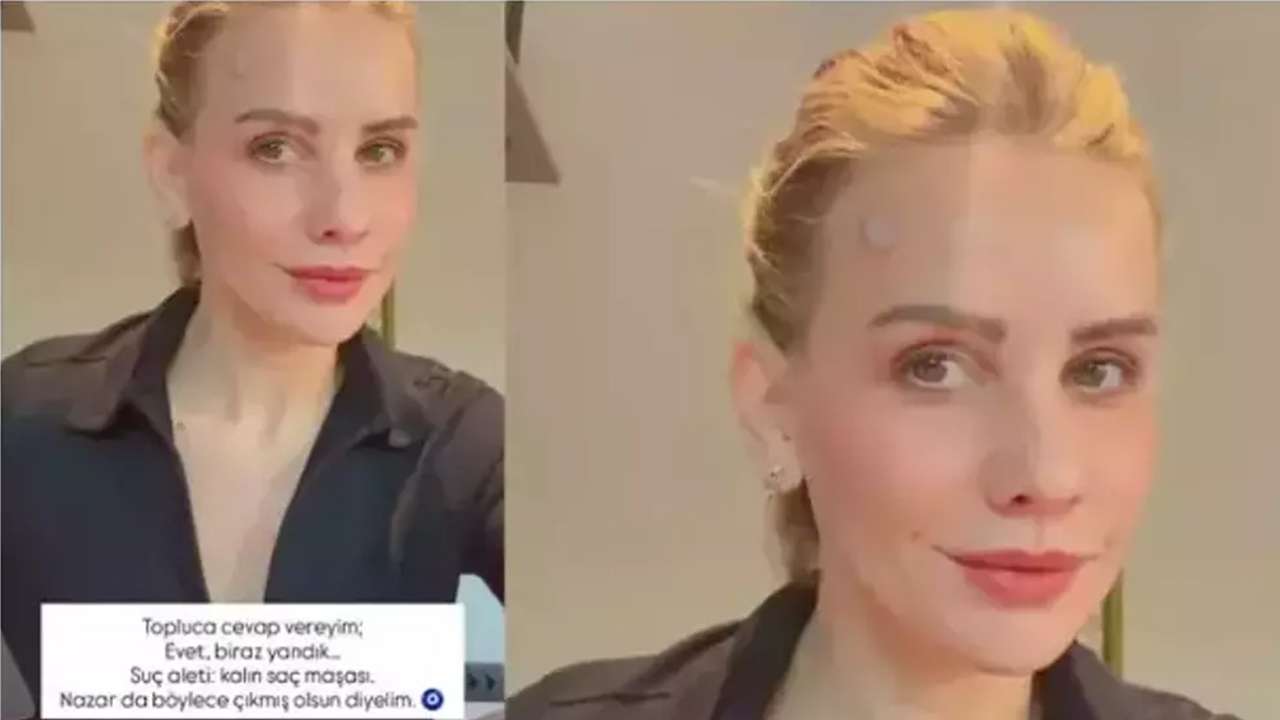 Yayın hazırlığında korkutan kaza: Esra Erol sosyal medyadan duyurdu!