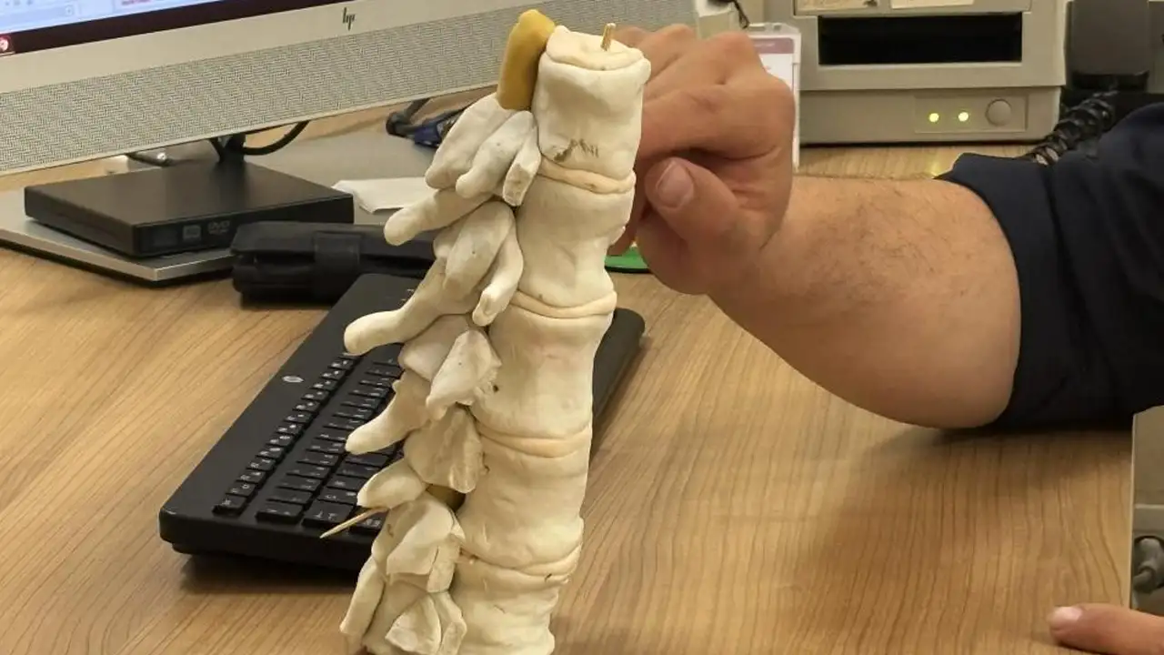 Gümüşhane’de bel fıtığı vakaları artıyor: Uzmandan önemli uyarı