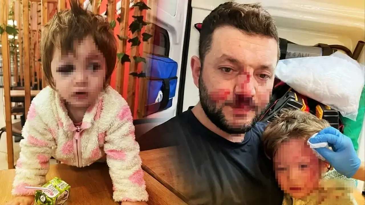Türkiye'nin gündemine oturmuştu: 14 aylık bebekten sonra şimdi de abisi hedefte!