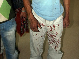 Evliliğe karşı çıkan babasını vurdu